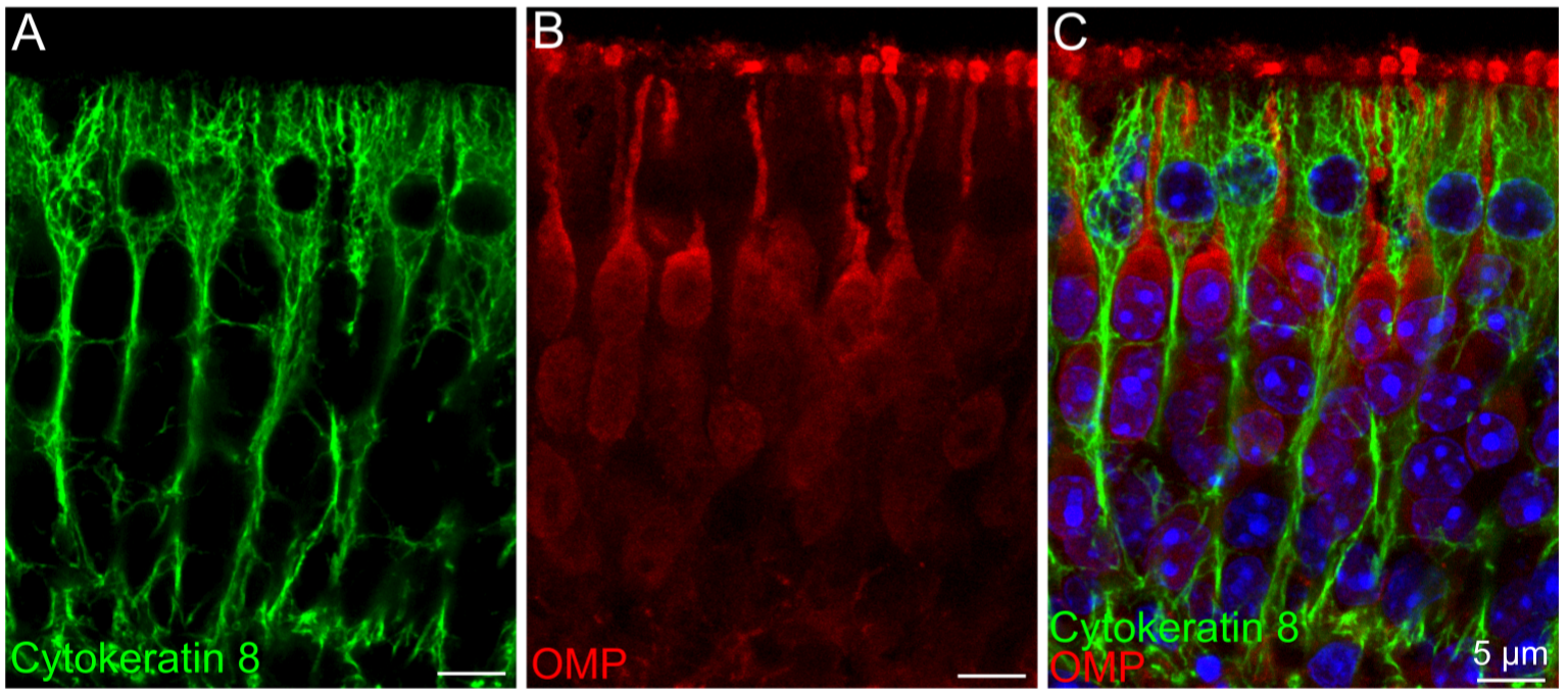 Técnicas de Histología Inmunohistoquímica